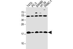 All lanes : Anti-IFITM5 Antibody (Center) at 1:4000 dilution Lane 1: T47D whole cell lysate Lane 2: PC-3 whole cell lysate Lane 3: S whole cell lysate Lane 4: HT-29 whole cell lysate Lane 5: NC-1 whole cell lysate Lysates/proteins at 20 μg per lane. (IFITM5 antibody  (AA 55-83))