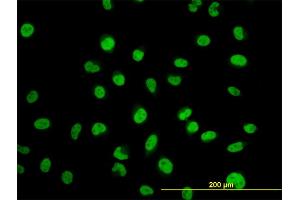 Immunofluorescence of monoclonal antibody to MYNN on HeLa cell.
