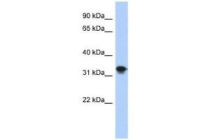 CENPP antibody used at 1 ug/ml to detect target protein. (CENPP antibody  (N-Term))