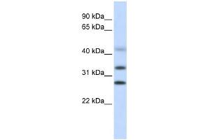 WB Suggested Anti-CENPH Antibody Titration: 0. (CENPH antibody  (Middle Region))