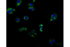 Immunofluorescent analysis of HepG2 cells using ABIN7143307 at dilution of 1:100 and Alexa Fluor 488-congugated AffiniPure Goat Anti-Rabbit IgG(H+L) (Adenosine A2b Receptor antibody  (AA 292-332))