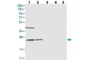 Western blot analysis of Lane 1: RT-4, Lane 2: U-251 MG, Lane 3: Human Plasma, Lane 4: Liver, Lane 5: Tonsil with UQCC polyclonal antibody  at 1:250-1:500 dilution.