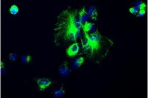 Image no. 2 for anti-Glial Fibrillary Acidic Protein (GFAP) antibody (ABIN1498437) (GFAP antibody)