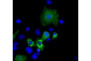 Image no. 1 for anti-Induced Myeloid Leukemia Cell Differentiation Protein Mcl-1 (MCL1) antibody (ABIN1499341) (MCL-1 antibody)