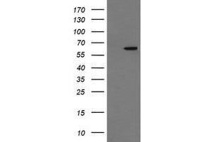 Image no. 1 for anti-Chaperonin Containing TCP1, Subunit 8 (Theta)-Like 2 (CCT8L2) antibody (ABIN1497484) (CCT8L2 antibody)