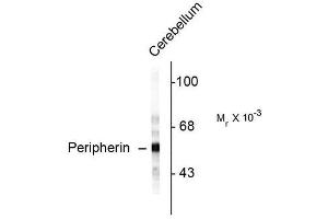 Image no. 1 for anti-Peripherin (PRPH) antibody (ABIN372702) (Peripherin antibody)