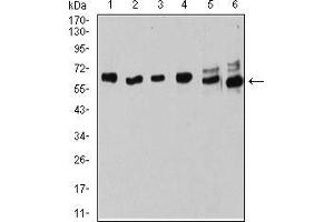 Western blot analysis using ESR1 mouse mAb against MOLT4 (1), Raji (2), MCF-7 (3), T47D (4), SK-Br-3 (5), and Hela (6) cell lysate. (Estrogen Receptor alpha antibody  (AA 2-185))