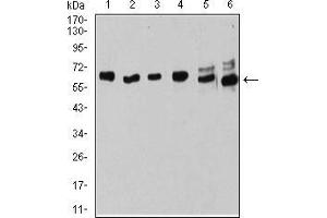Western blot analysis using ESR1 mouse mAb against MOLT4 (1), Raji (2), MCF-7 (3), T47D (4), SK-Br-3 (5), and Hela (6) cell lysate. (Estrogen Receptor alpha antibody  (AA 2-185))