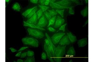 Immunofluorescence of monoclonal antibody to TUBA1 on HeLa cell. (TUBA4A antibody  (AA 1-448))