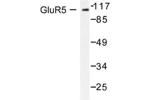 Image no. 1 for anti-Glutamate Receptor, Ionotropic, Kainate 1 (GRIK1) antibody (ABIN265438)