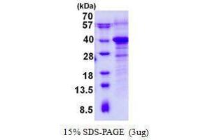 Figure annotation denotes ug of protein loaded and % gel used. (RWDD1 Protein)