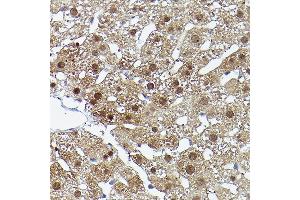 Immunohistochemistry of paraffin-embedded rat liver using ERK5 Rabbit pAb (ABIN3022944, ABIN3022945, ABIN3022946 and ABIN6219309) at dilution of 1:50 (40x lens). (MAPK7 antibody  (AA 1-310))