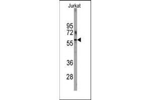 Image no. 1 for anti-6-phosphofructo-2-Kinase/fructose-2,6-Biphosphatase 1 (PFKFB1) (N-Term) antibody (ABIN360656) (PFKFB1 antibody  (N-Term))