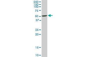 HDAC3 monoclonal antibody (M02), clone 3E11. (HDAC3 antibody  (AA 319-428))