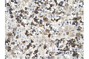 Hemoglobin Zeta antibody was used for immunohistochemistry at a concentration of 4-8 ug/ml to stain Hemopoietic cells (arrows) in Human Liver. (HBZ antibody  (N-Term))