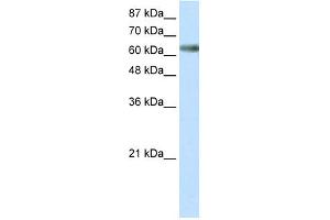 WB Suggested Anti-ZNF447 Antibody Titration: 0. (ZSCAN18 antibody  (Middle Region))