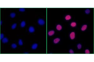 Immunofluorescence (IF) image for anti-Replication Protein A2, 32kDa (RPA2) (pSer4), (pSer8) antibody (ABIN7453379) (Recombinant RPA2 antibody  (pSer4, pSer8))