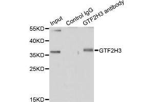 Immunoprecipitation analysis of 200 μg extracts of HT-29 cells using 1 μg GTF2H3 antibody (ABIN5974322). (GTF2H3 antibody)