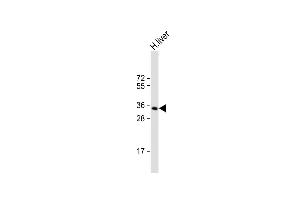 Anti-GNMT Antibody (Center) at 1:1000 dilution + human liver lysate Lysates/proteins at 20 μg per lane.