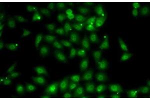 Immunofluorescence analysis of MCF7 cells using MBNL1 Polyclonal Antibody (MBNL1 antibody)
