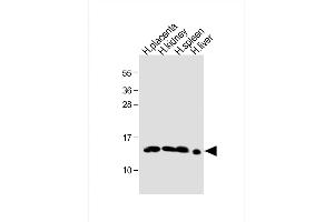 All lanes : Anti- HBE1 Antibody (Center) at 1:1000 dilution Lane 1: human placenta lysate Lane 2: human kidney lysate Lane 3: human spleen lysate Lane 4: human liver lysate Lysates/proteins at 20 μg per lane. (Hemoglobin, epsilon 1 (HBe1) (AA 55-83) antibody)