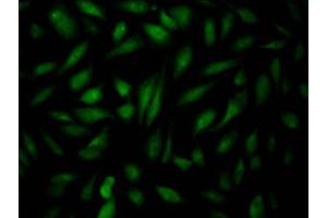 Immunofluorescence staining of Hela Cells with ABIN7127543 at 1:50, counter-stained with DAPI. (Recombinant EPAS1 antibody)