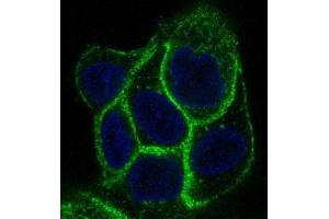 Immunofluorescent analysis of A431 cells, using EGFR Antibody .