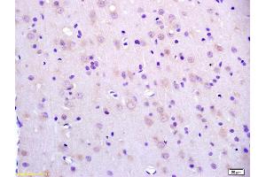 Formalin-fixed and paraffin embedded rat brain labeled with Anti-BCAT2/BCAM Polyclonal Antibody, Unconjugated (ABIN718511) at 1:200 followed by conjugation to the secondary antibody and DAB staining. (BCAT2 antibody  (AA 101-200))