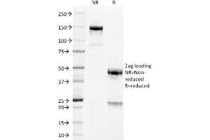 SDS-PAGE Analysis Purified PLAP Mouse Monoclonal Antibody (GM022). (PLAP antibody)