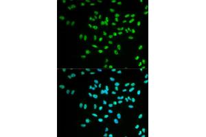 Immunofluorescence analysis of MCF-7 cells using FANCD2 antibody. (FANCD2 antibody)