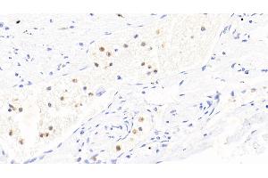 #VALUE! (S100A8/A9 Complex (Calprotectin) antibody  (AA 1-114))