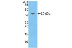 Detection of Recombinant CSF2Rb, Human using Polyclonal Antibody to Colony Stimulating Factor 2 Receptor Beta (CSF2Rb) (CD131 antibody  (AA 133-233))
