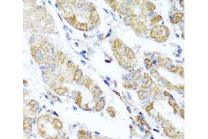 Immunohistochemistry of paraffin-embedded Human stomach using DARS2 Polyclonal Antibody at dilution of 1:100 (40x lens). (DARS2 antibody)