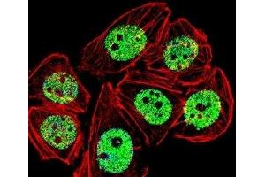 Fluorescent confocal image of A549 cells stained with FOXG1 antibody. (FOXG1 antibody  (AA 225-252))