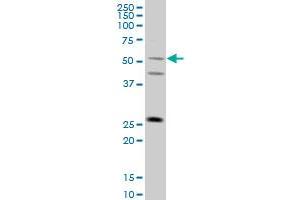 FLJ36180 monoclonal antibody (M01), clone 4F8 Western Blot analysis of FLJ36180 expression in A-431 .