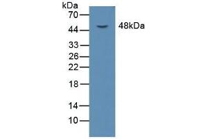 Detection of LOX1 in Mouse Liver Tissue using Polyclonal Antibody to Lectin Like Oxidized Low Density Lipoprotein Receptor 1 (LOX1) (OLR1 antibody  (AA 51-314))
