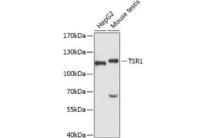 Western blot analysis of extracts of various cell lines, using TSR1 antibody (ABIN6132976, ABIN6149654, ABIN6149655 and ABIN6220781) at 1:3000 dilution. (TSR1 antibody  (AA 455-804))