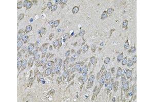 Immunohistochemistry of paraffin-embedded Mouse brain using PRKAB2 Polyclonal Antibody at dilution of 1:100 (40x lens). (PRKAB2 antibody)
