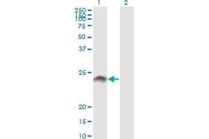 Western Blot analysis of WISP2 expression in transfected 293T cell line by WISP2 monoclonal antibody (M09), clone 3D10. (WISP2 antibody  (AA 24-250))