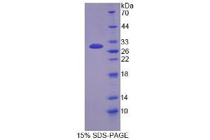 SDS-PAGE analysis of Mouse Docking Protein 3 Protein. (DOK3 Protein)