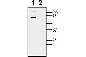 Western blot analysis of human  neuroblastoma cell lysate:1.