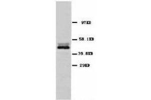 Image no. 1 for anti-Enolase 2 (Gamma, Neuronal) (ENO2) (C-Term) antibody (ABIN1493043) (ENO2/NSE antibody  (C-Term))