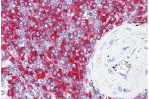 Immunohistochemistry (Formalin-fixed Paraffin-embedded Sections) (IHC (fp)) image for anti-Ribosomal Protein S2 (RPS2) (AA 198-294) antibody (ABIN574329)