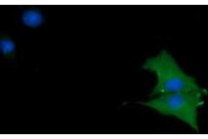 Image no. 3 for anti-Cancer/testis Antigen 1B (CTAG1B) antibody (ABIN1499893) (CTAG1B antibody)