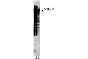 Western blot analysis of phosphotyrosine on A431 cell lysate. (Phosphotyrosine antibody)