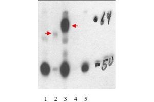 Image no. 1 for anti-Thyroid Hormone Receptor, beta (THRB) (Isoform 1), (Isoform beta-1), (N-Term) antibody (ABIN401449) (THRB antibody  (Isoform 1, Isoform beta-1, N-Term))