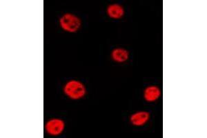 ABIN6279892 staining 293T by IF/ICC. (USP16 antibody  (N-Term))