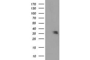 Western Blotting (WB) image for anti-Nudix (Nucleoside Diphosphate Linked Moiety X)-Type Motif 6 (NUDT6) antibody (ABIN1499873) (NUDT6 antibody)