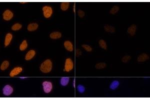 Immunofluorescence analysis of U-2 OS cells using Acetyl-Histone H3-K9/K14/K18/K23/K27 Polyclonal Antibody at dilution of 1:100. (Histone 3 antibody  (acLys9, acLys14, acLys18, acLys23, acLys27))