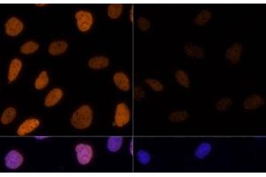 Immunofluorescence analysis of U-2 OS cells using Acetyl-Histone H3-K9/K14/K18/K23/K27 Polyclonal Antibody at dilution of 1:100. (Histone 3 antibody  (acLys9, acLys14, acLys18, acLys23, acLys27))